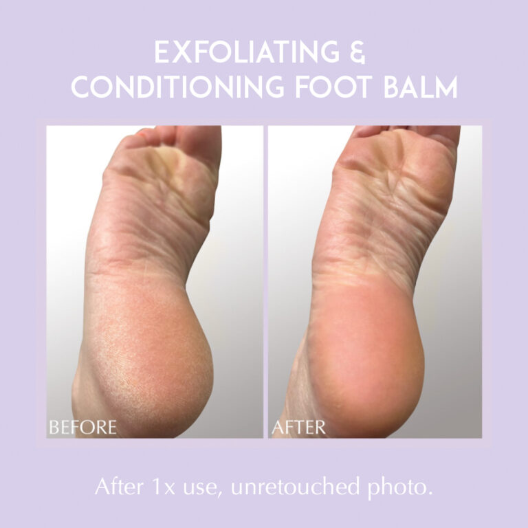 Bild till sociala medier Exuviance Exfoliating & Conditioning Foot Balm 1