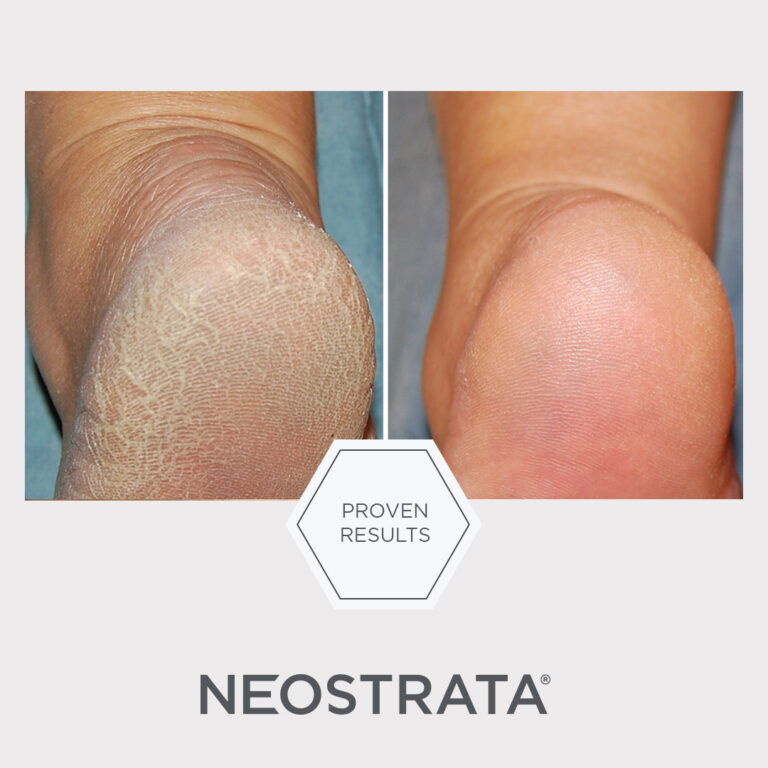 Bild till sociala medier NEOSTRATA Problem Dry Skin Cream 1