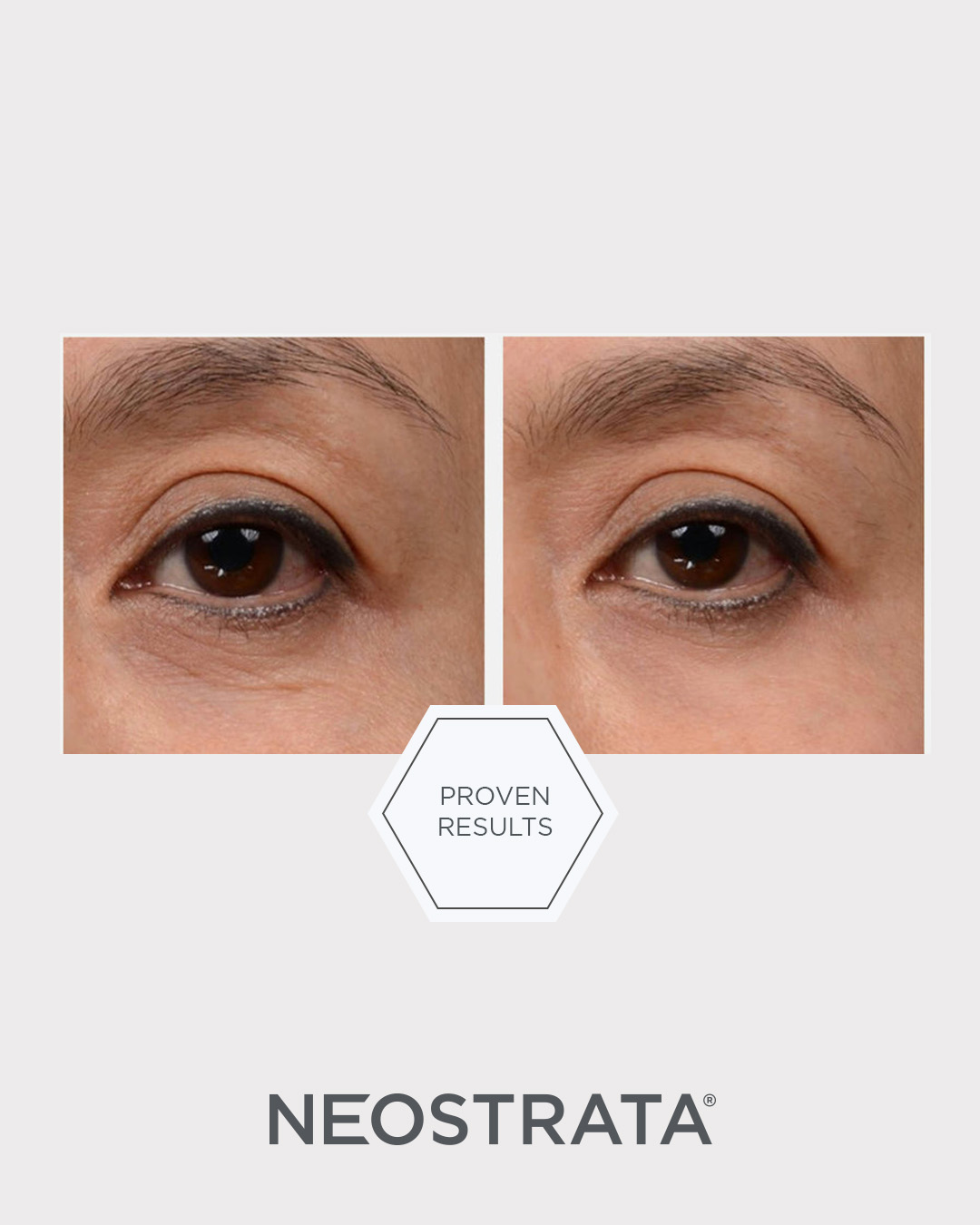 Bild till sociala medier NEOSTRATA Intensive Eye Therapy 1