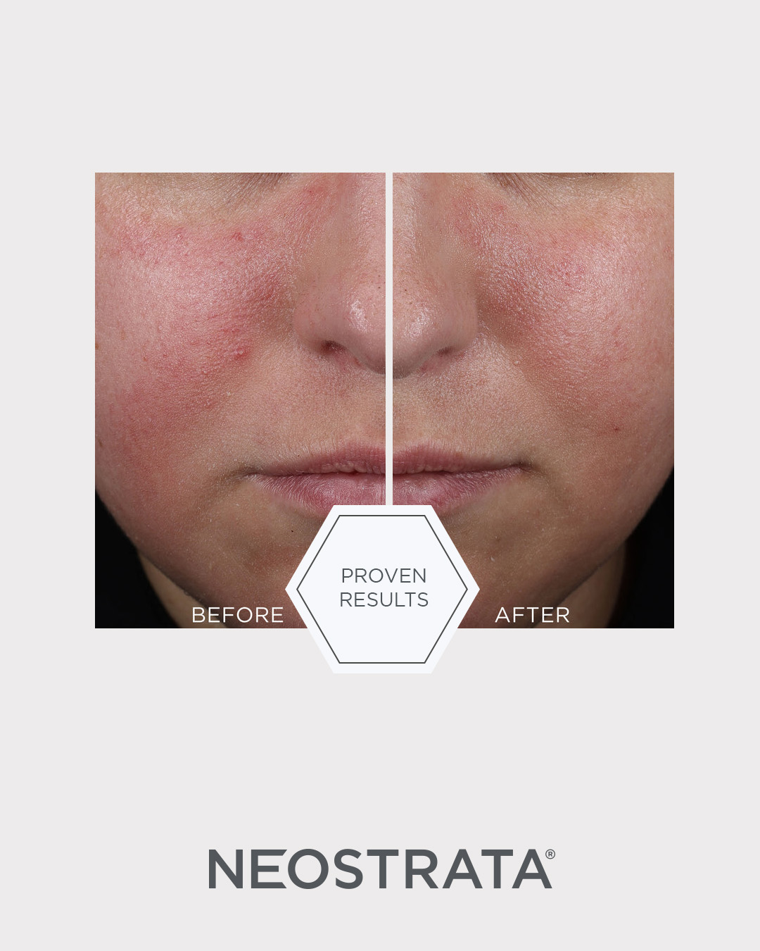 Bild till sociala medier NEOSTRATA Mandelic Clarifying Hydragel 1