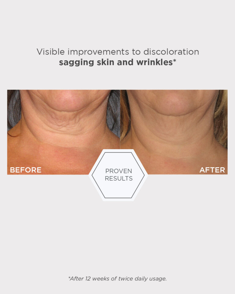 Bild till sociala medier NEOSTRATA Triple Firming Neck Cream 4