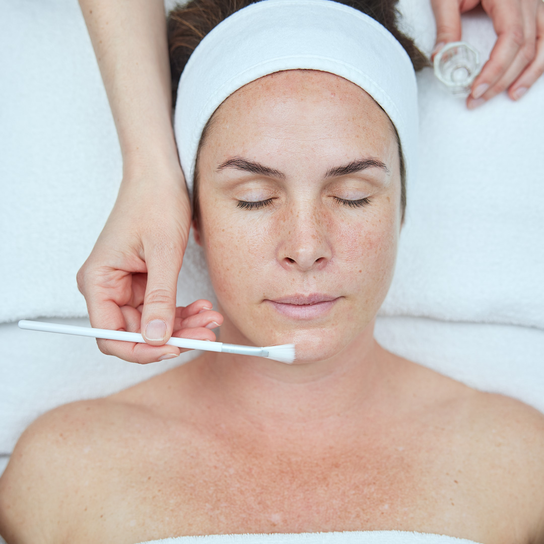 Bild till sociala medier NEOSTRATA behandling 1