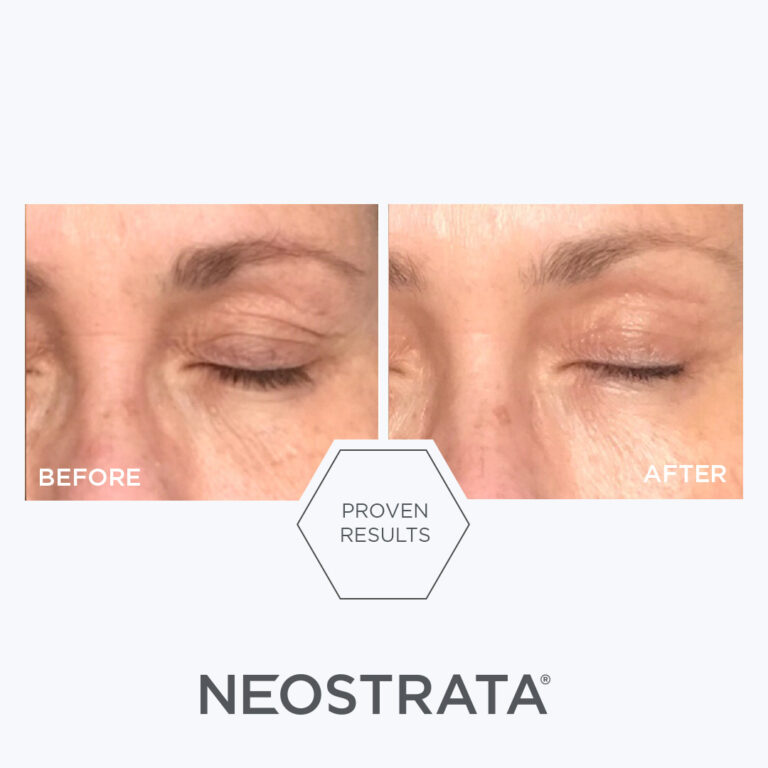 Bild till sociala medier NEOSTRATA Skin Active Intensive Eye Therapy 1