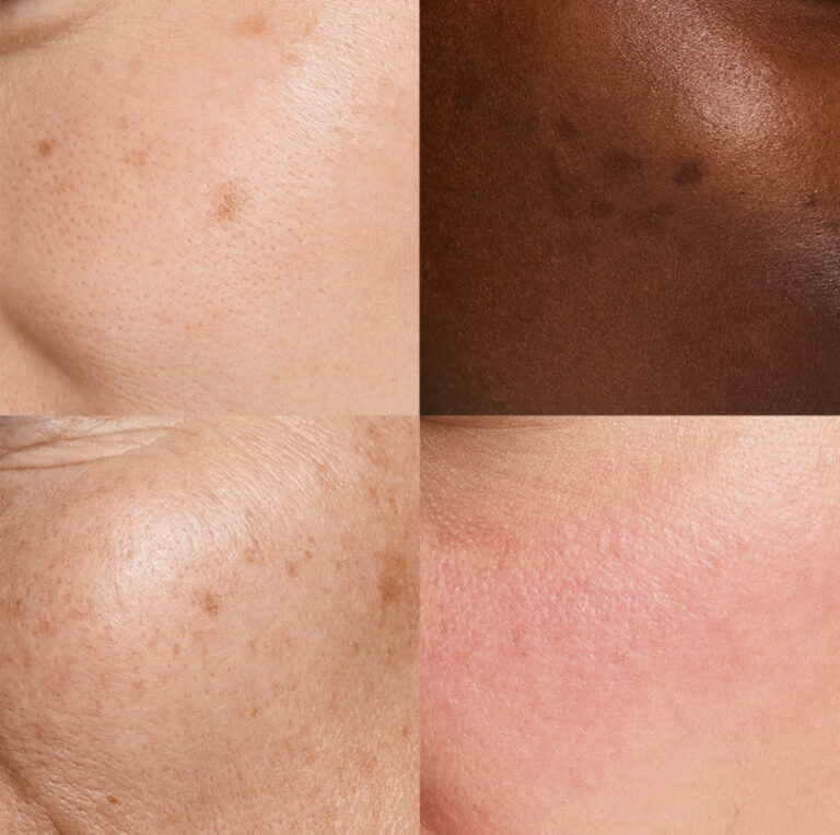 Bild till sociala medier NEOSTRATA hud