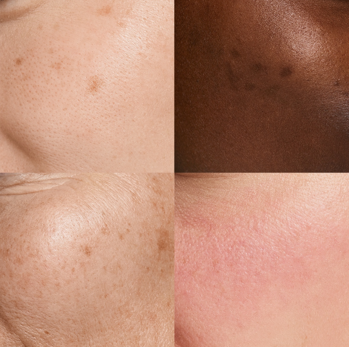 Bild till sociala medier NEOSTRATA hud