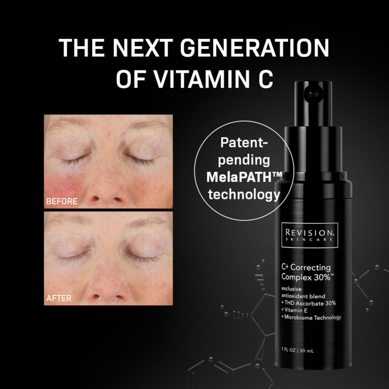 Bild till sociala medier Revision Skincare 1