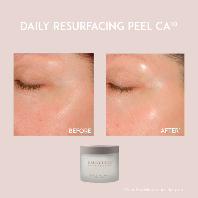 Bild till sociala medier Exuviance Daily Resurfacing Peel CA10 2
