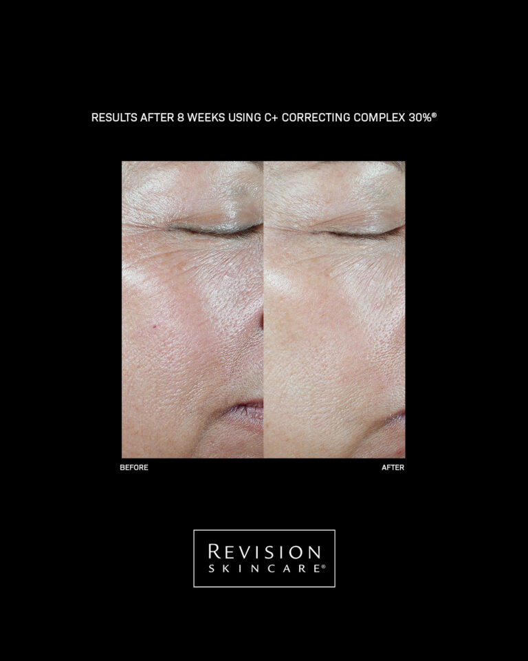 Bild till sociala medier Revision Skincare C Correcting